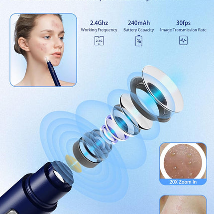 Visual Blackhead Remover with Camera 20X Extractor Kit for iPhone/Android